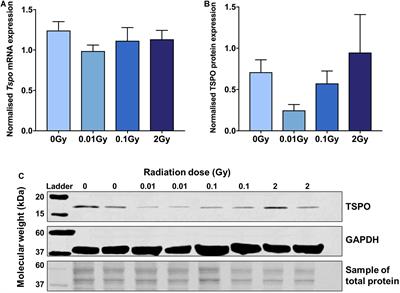 Mitochondrial Translocator Protein (TSPO) Expression in the Brain After Whole Body Gamma Irradiation